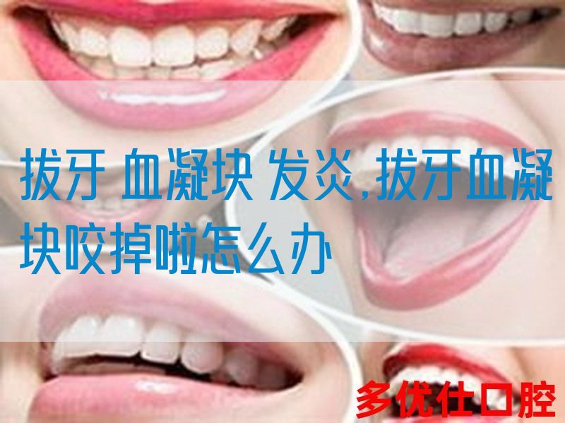 拔牙 血凝块 发炎,拔牙血凝块咬掉啦怎么办(图1)