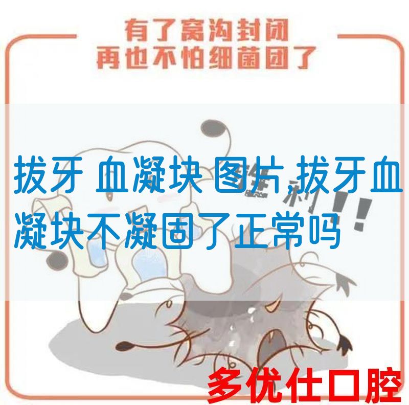 拔牙 血凝块 图片,拔牙血凝块不凝固了正常吗(图1)