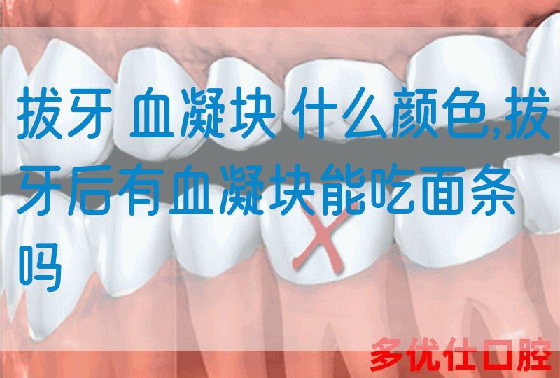 拔牙 血凝块 什么颜色,拔牙后有血凝块能吃面条吗(图1)