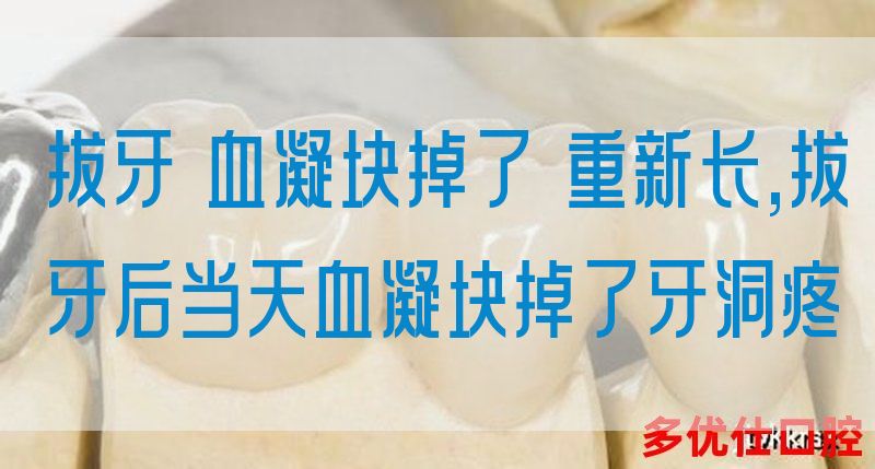 拔牙 血凝块掉了 重新长,拔牙后当天血凝块掉了牙洞疼(图1)