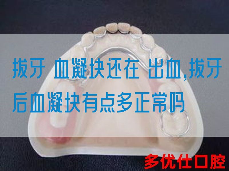 拔牙 血凝块还在 出血,拔牙后血凝块有点多正常吗(图1)