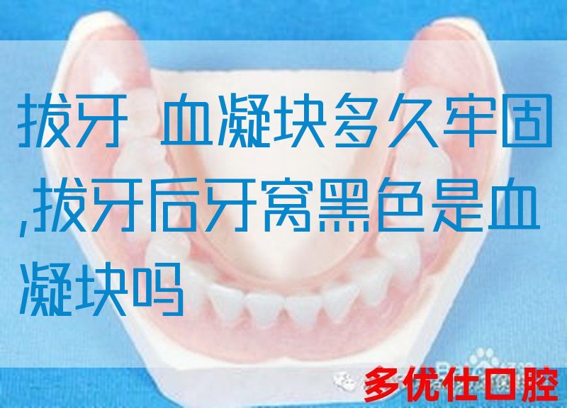 拔牙 血凝块多久牢固,拔牙后牙窝黑色是血凝块吗(图1)
