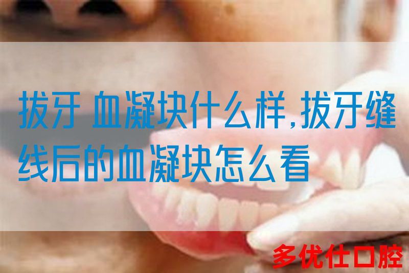 拔牙 血凝块什么样,拔牙缝线后的血凝块怎么看(图1)