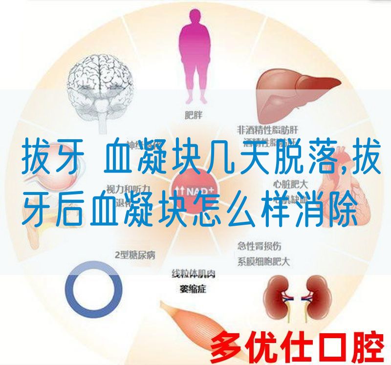 拔牙 血凝块几天脱落,拔牙后血凝块怎么样消除(图1)