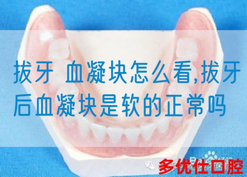 拔牙 血凝块怎么看,拔牙后血凝块是软的正常吗(图1)