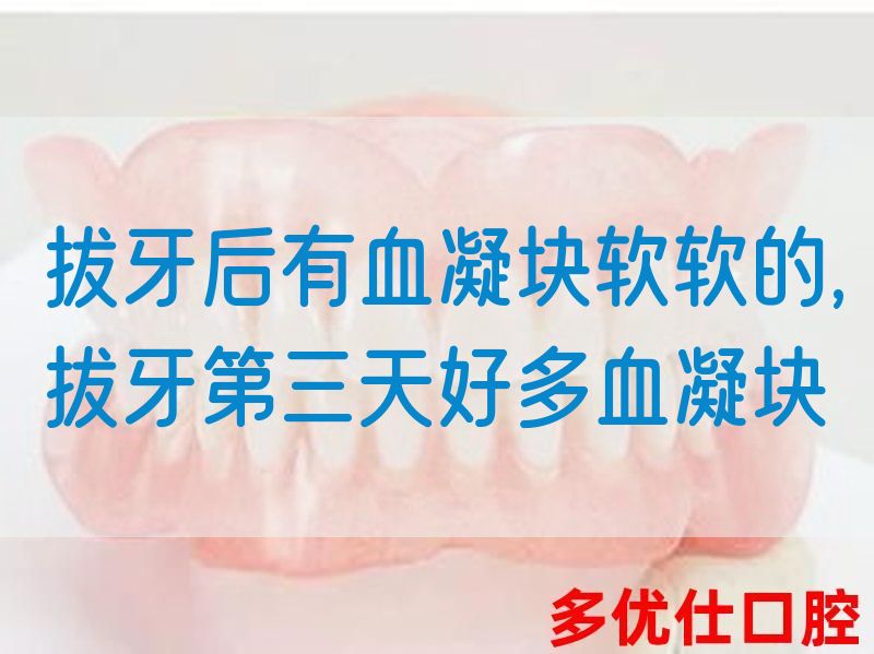 拔牙后有血凝块软软的,拔牙第三天好多血凝块