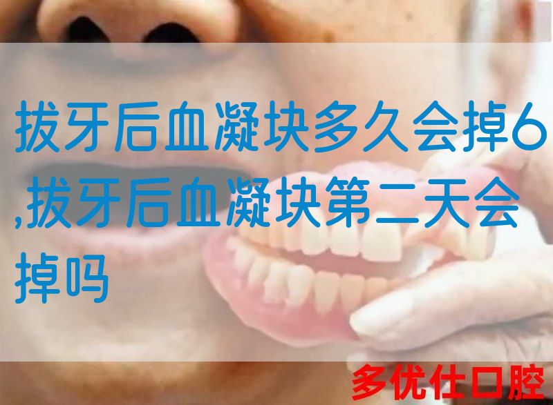 拔牙后血凝块多久会掉6,拔牙后血凝块第二天会掉吗