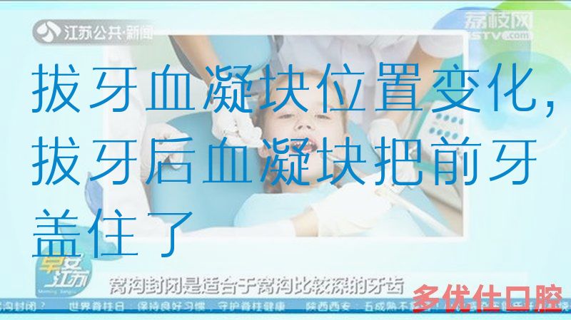 拔牙血凝块位置变化,拔牙后血凝块把前牙盖住了