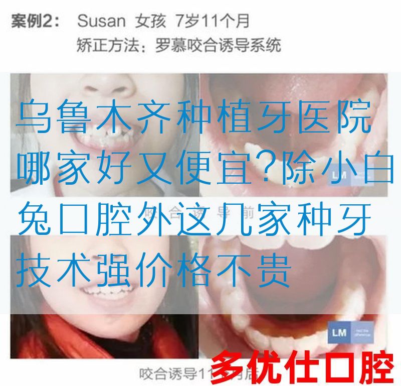 *种植牙医院哪家好又便宜?除小白兔口腔外这几家种牙技术强价格不贵