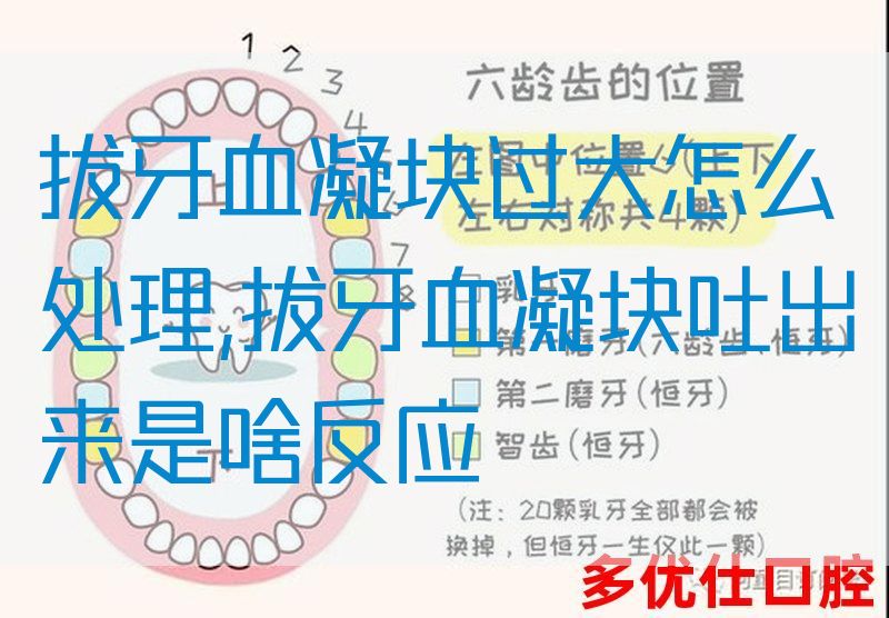 拔牙血凝块过大怎么处理,拔牙血凝块吐出来是啥反应