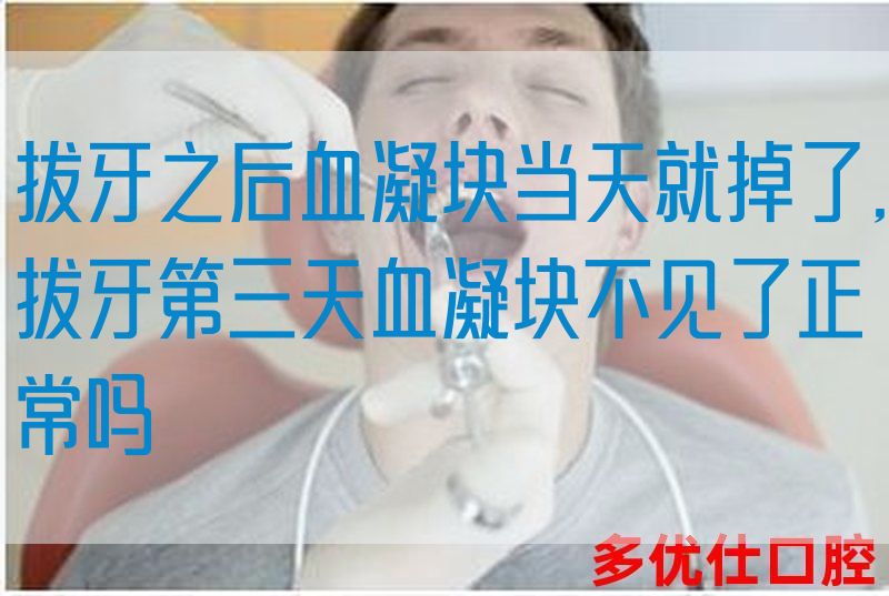 拔牙之后血凝块当天就掉了,拔牙第三天血凝块不见了正常吗