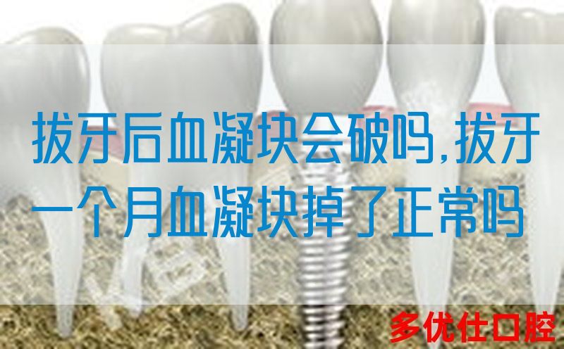 拔牙后血凝块会破吗,拔牙一个月血凝块掉了正常吗