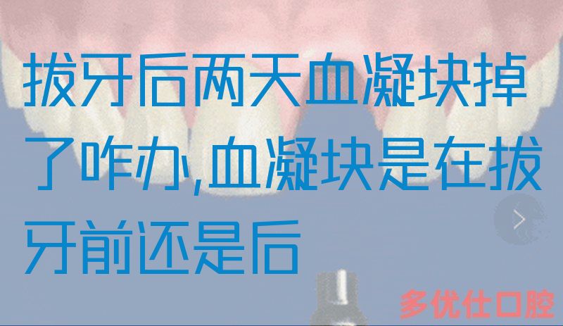 拔牙后两天血凝块掉了咋办,血凝块是在拔牙前还是后