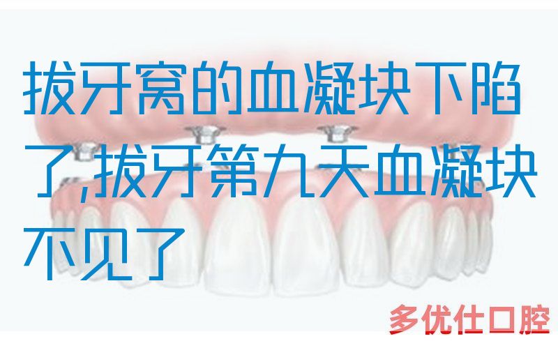 拔牙窝的血凝块下陷了,拔牙第九天血凝块不见了