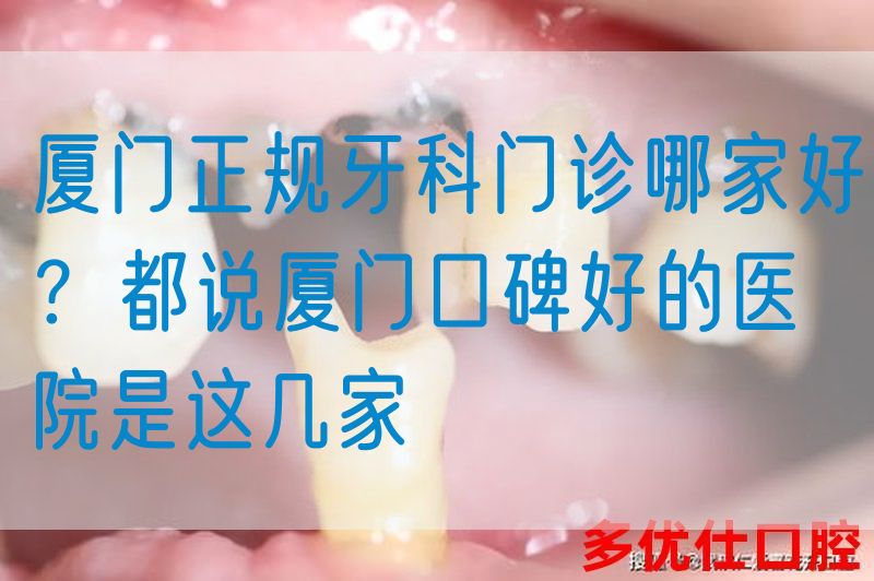 厦门正规牙科门诊哪家好？都说厦门口碑好的医院是这几家