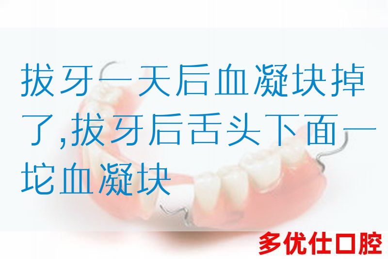 拔牙一天后血凝块掉了,拔牙后舌*下面一坨血凝块