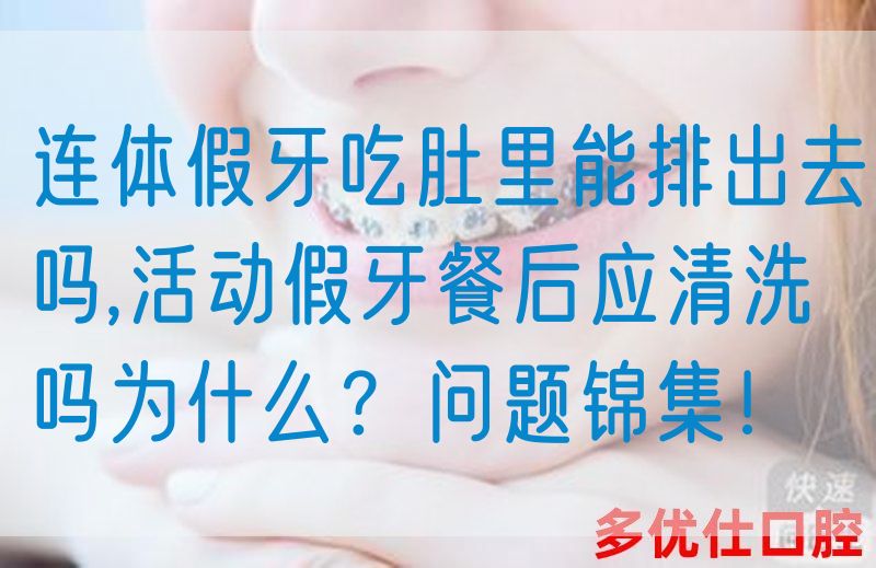 连体假牙吃*里能排出去吗,活动假牙餐后应清洗吗为什么？问题锦集！