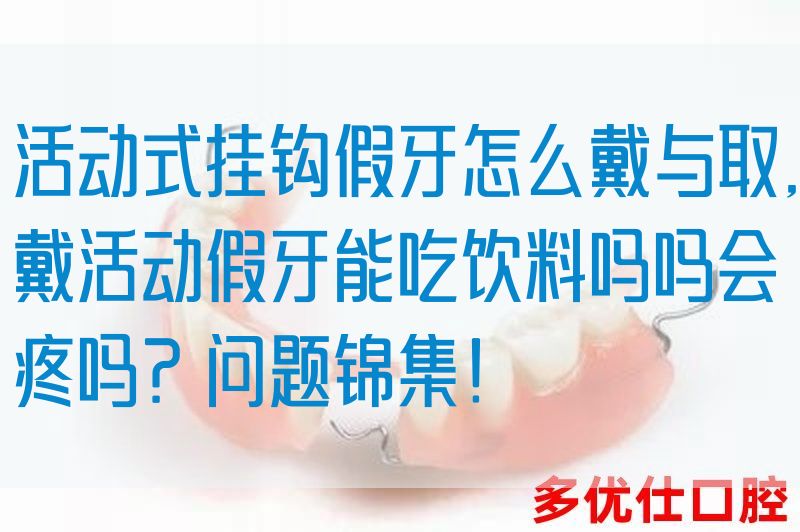活动式挂钩假牙怎么戴与取,戴活动假牙能吃饮料吗吗会疼吗？问题锦集！