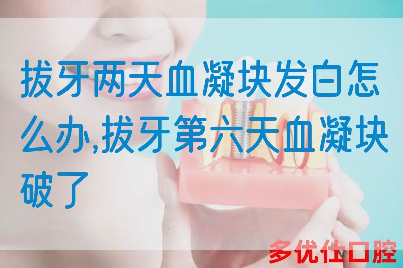 拔牙两天血凝块发白怎么办,拔牙第六天血凝块破了