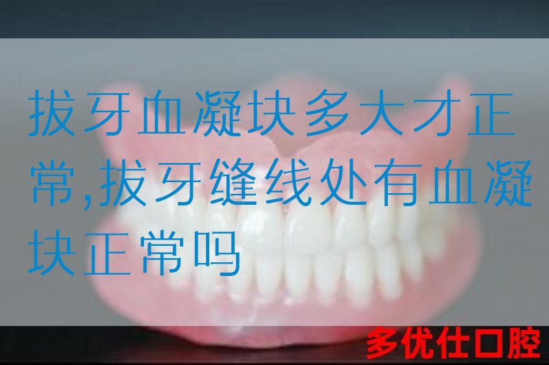 拔牙血凝块多大才正常,拔牙缝线处有血凝块正常吗