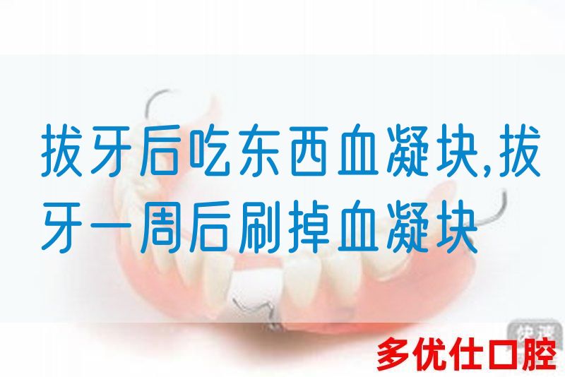 拔牙后吃东西血凝块,拔牙一周后刷掉血凝块