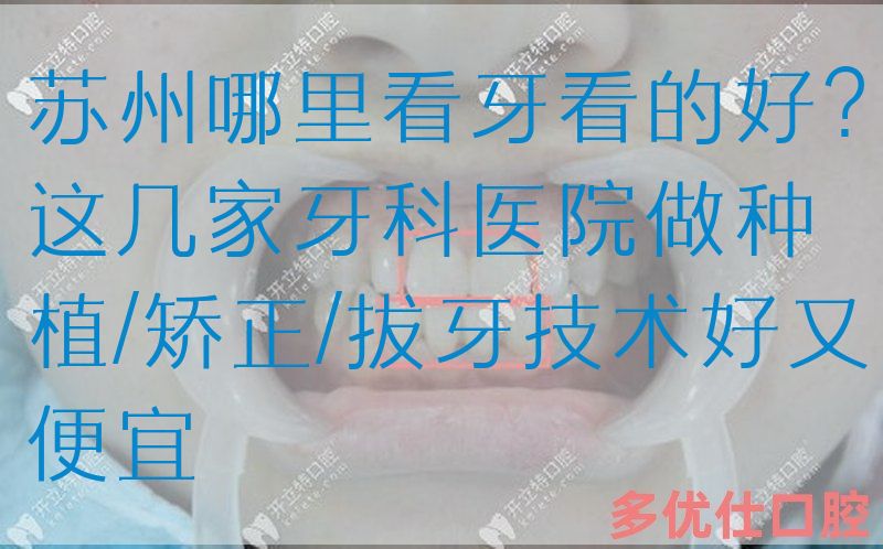 苏州哪里看牙看的好？这几家牙科医院做种植/矫正/拔牙技术好又便宜