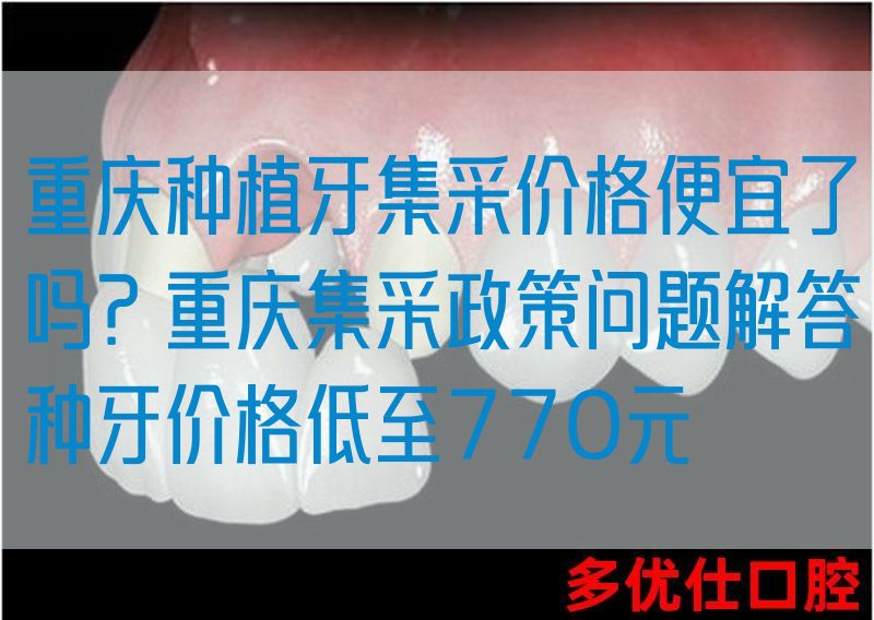 重庆种植牙集采价格便宜了吗？重庆集采政策问题解答种牙价格低至770元