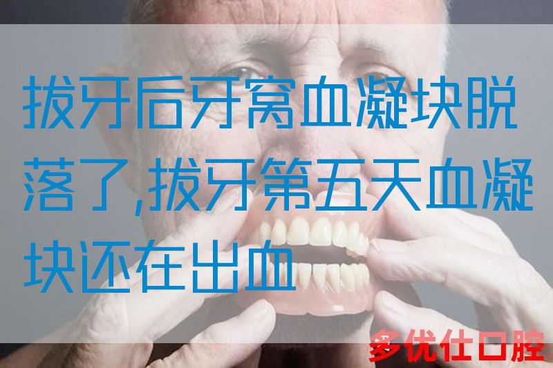 拔牙后牙窝血凝块脱落了,拔牙第五天血凝块还在出血