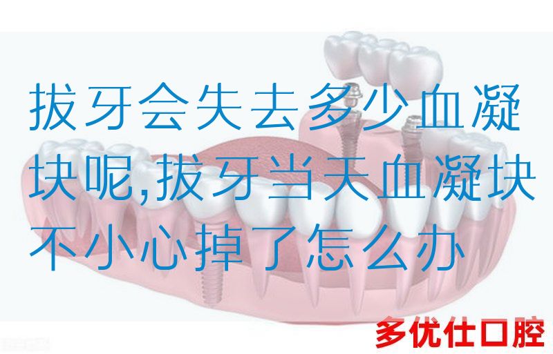 拔牙会失去多少血凝块呢,拔牙当天血凝块不小心掉了怎么办