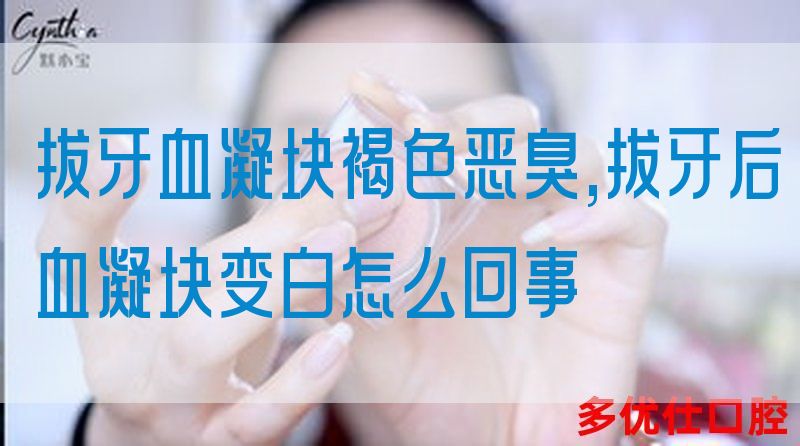 拔牙血凝块褐色恶臭,拔牙后血凝块变白怎么回事