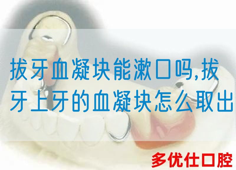 拔牙血凝块能漱口吗,拔牙上牙的血凝块怎么取出