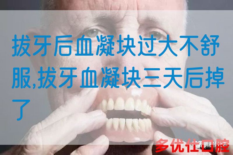 拔牙后血凝块过大不舒服,拔牙血凝块三天后掉了