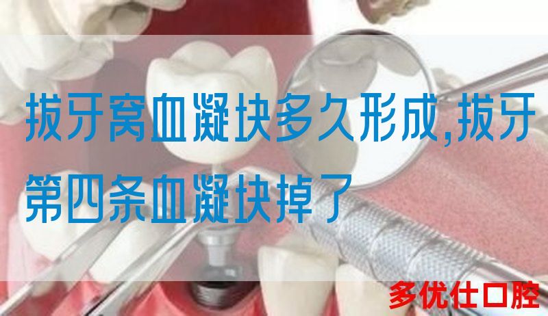 拔牙窝血凝块多久形成,拔牙第四条血凝块掉了