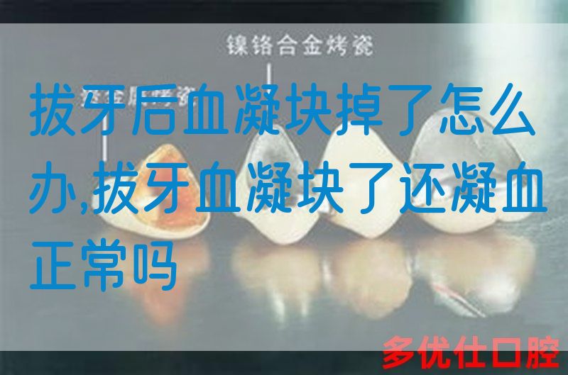 拔牙后血凝块掉了怎么办,拔牙血凝块了还凝血正常吗