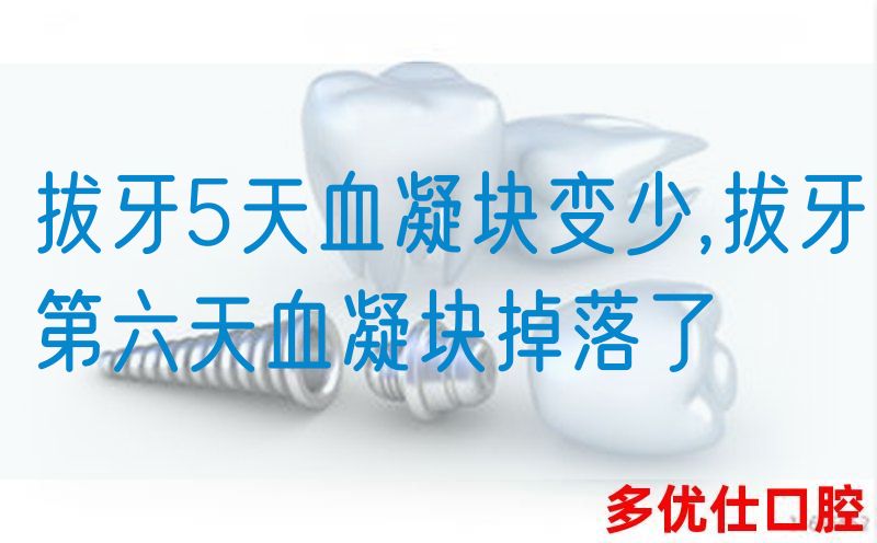 拔牙5天血凝块变少,拔牙第六天血凝块掉落了