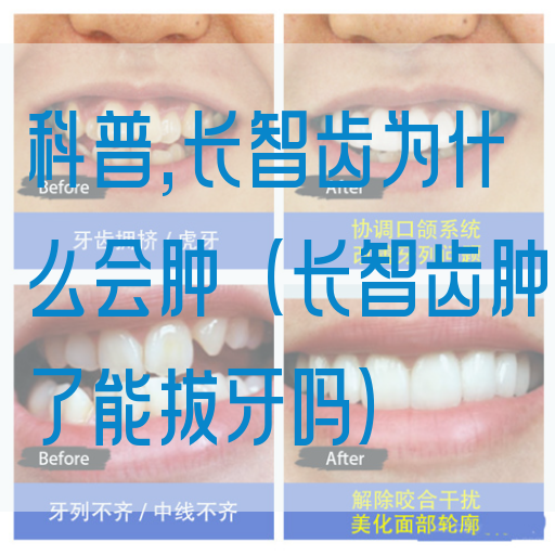 科普,长智齿为什么会肿（长智齿肿了能拔牙吗）(图1)