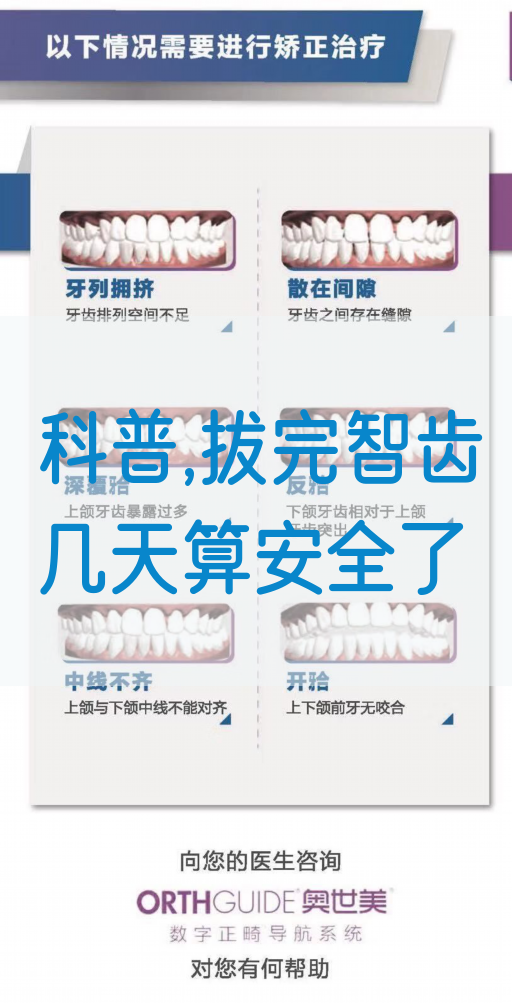 科普,拔完智齿几天算安全了