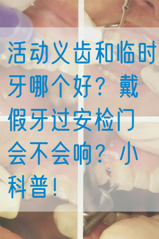 活动义齿和临时牙哪个好？戴假牙过安检门会不会响？小科普！