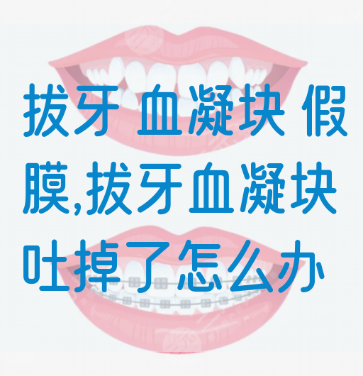 拔牙 血凝块 假膜,拔牙血凝块吐掉了怎么办