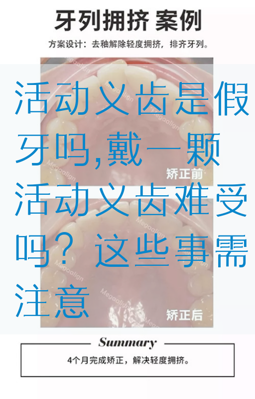 活动义齿是假牙吗,戴一颗活动义齿难受吗？这些事需注意