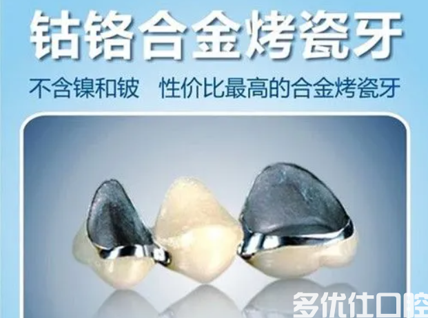 烤瓷牙多少钱一颗？盘点做烤瓷牙的注意事项以及适用人群