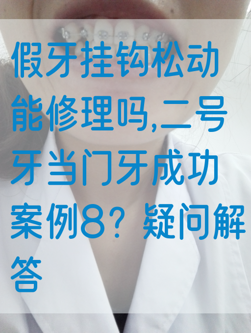 假牙挂钩松动能修理吗,二号牙当门牙成功案例8？疑问解答
