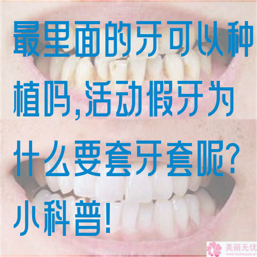 最里面的牙可以种植吗,活动假牙为什么要套牙套呢？小科普！