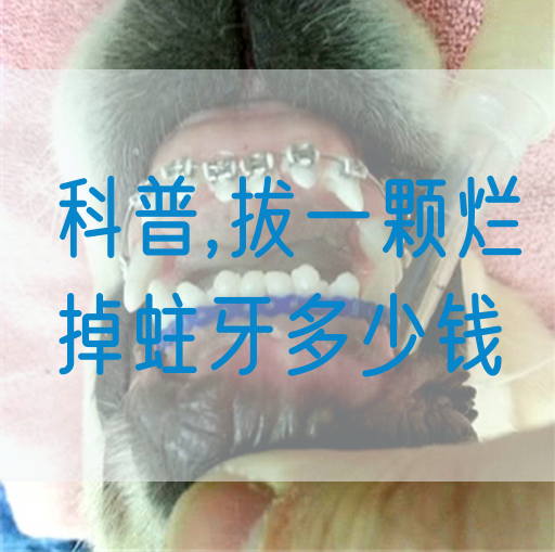 科普,拔一颗烂掉蛀牙多少钱