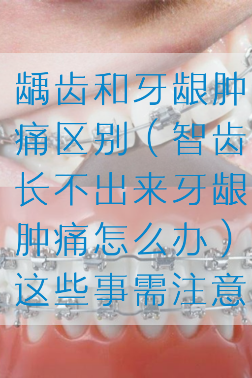 龋齿和牙龈肿痛区别（智齿长不出来牙龈肿痛怎么办）这些事需注意