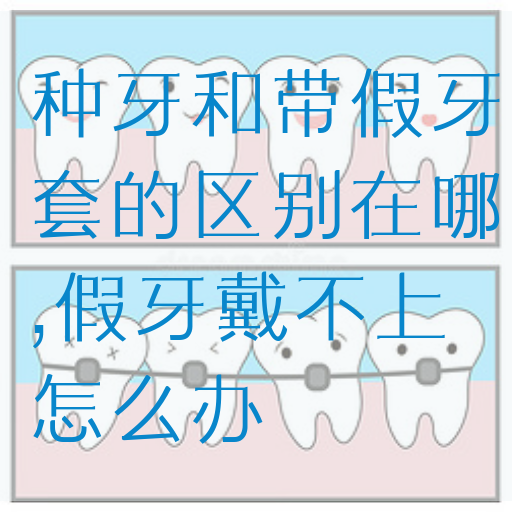 种牙和带假牙套的区别在哪,假牙戴不上怎么办(图1)