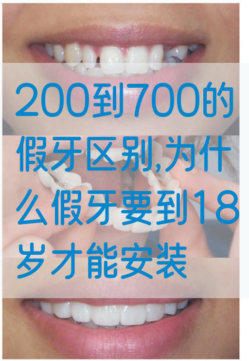 200到700的假牙区别,为什么假牙要到18岁才能安装(图1)