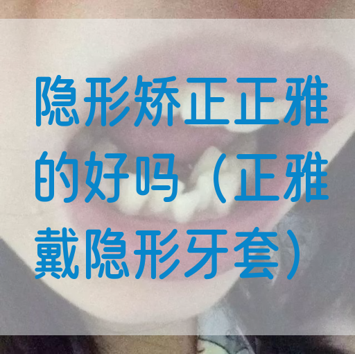 隐形矫正正雅的好吗（正雅戴隐形牙套）(图1)