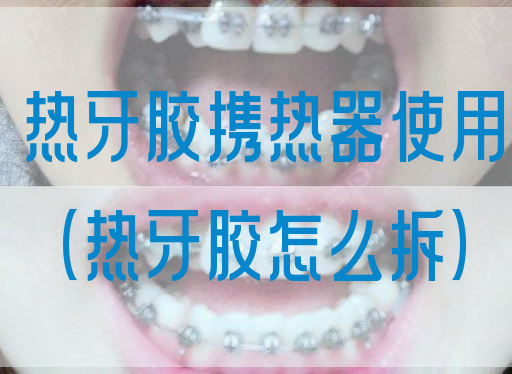 热牙胶携热器使用（热牙胶怎么拆）(图1)