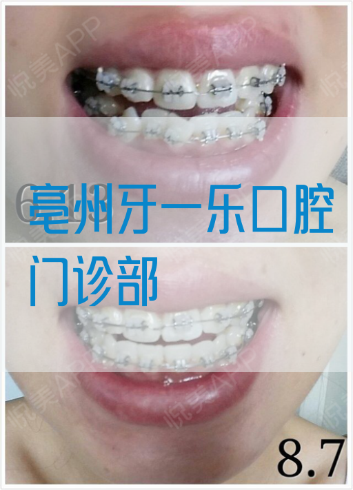 亳州牙一乐口腔门诊部